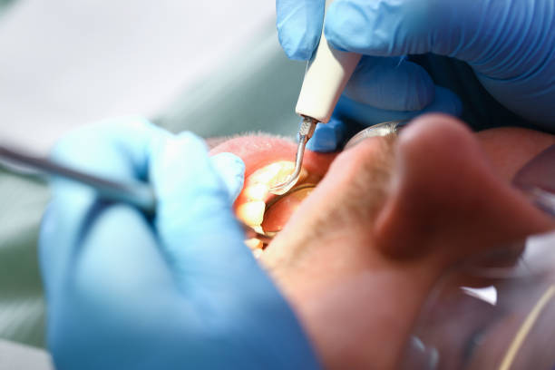 Best Broken or Cracked Tooth Emergency Dentist in Inkster, MI